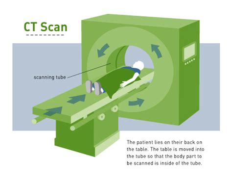 leesburg cat scan procedure|CT Scan (CAT Scan): Purpose, Procedure, Risks, Side .